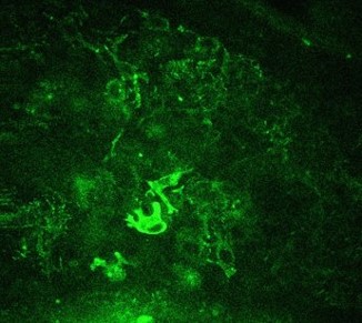 Multiphoton Microscopy
